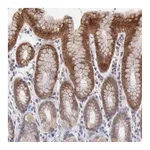 Atlas Antibodies Anti-OAS1 Antibody