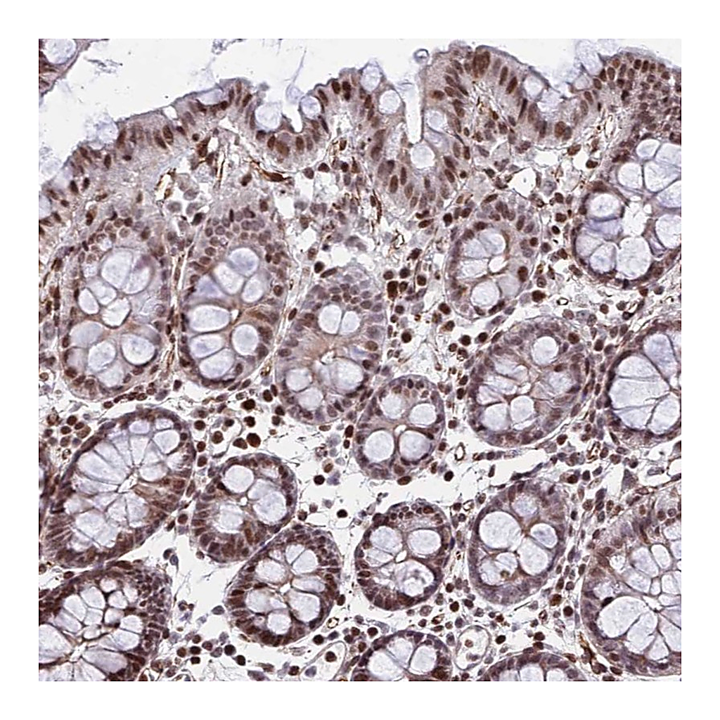 Atlas Antibodies Anti-NYAP2 Antibody