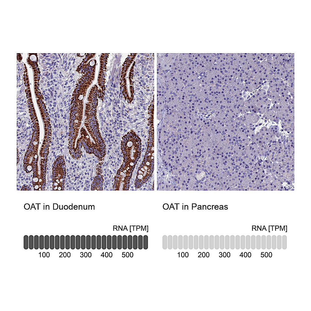 Atlas Antibodies Anti-OAT Antibody