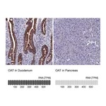 Atlas Antibodies Anti-OAT Antibody