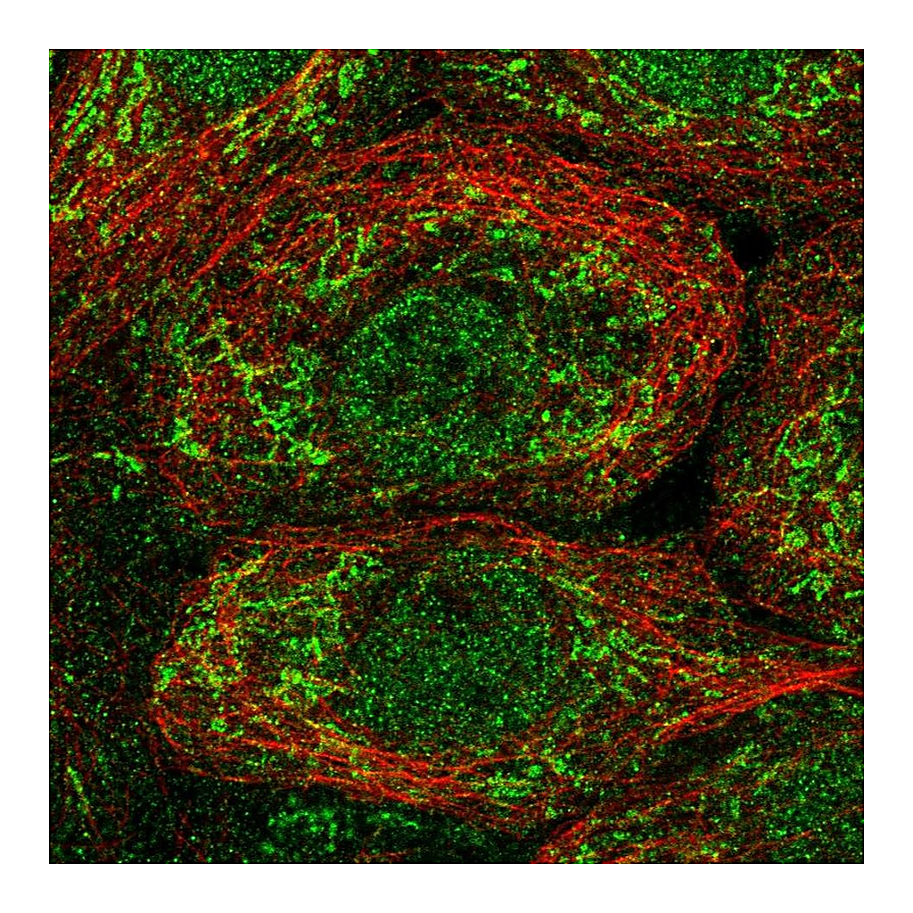 Atlas Antibodies Anti-OAT Antibody