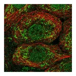 Atlas Antibodies Anti-OAT Antibody