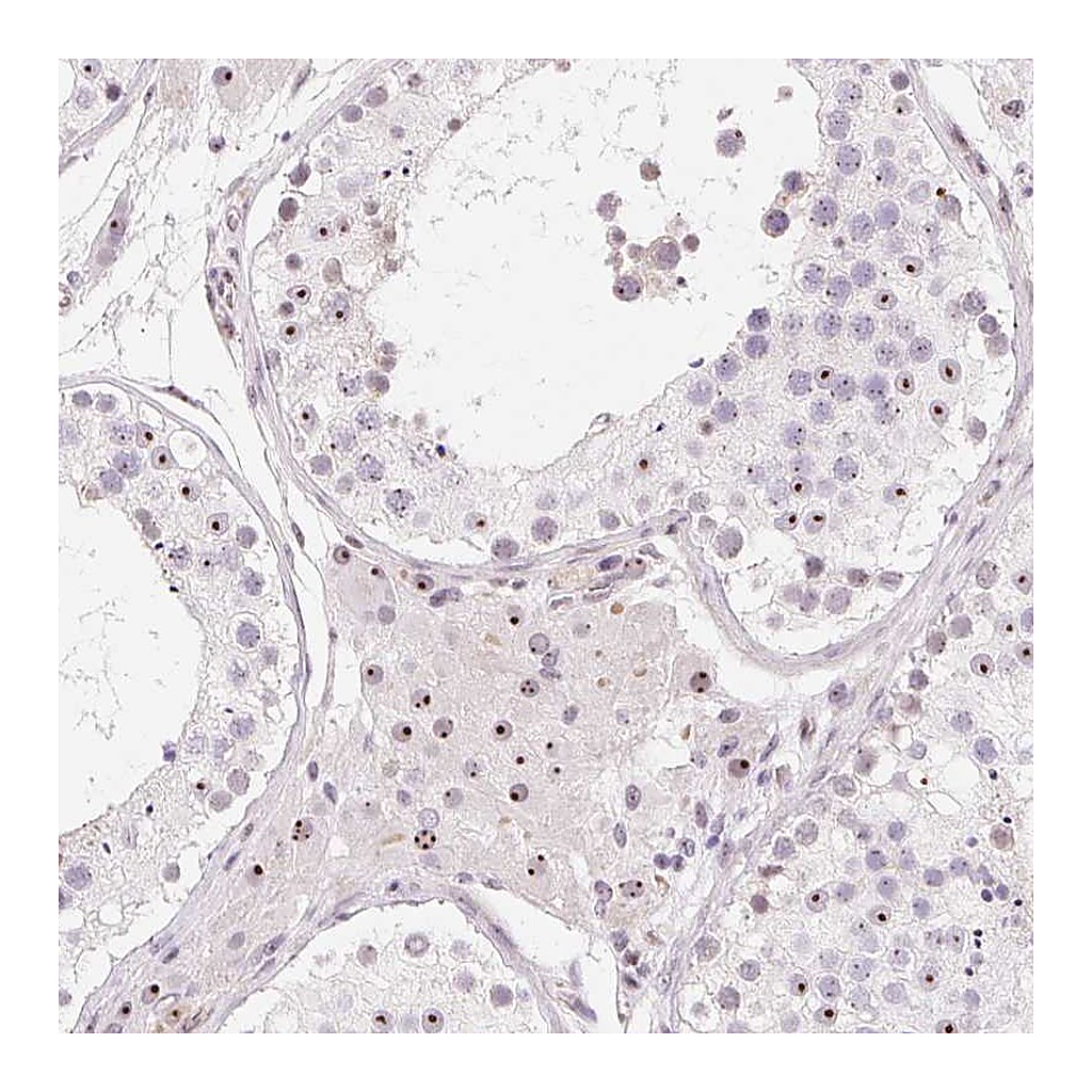 Atlas Antibodies Anti-OBP2A Antibody