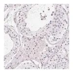 Atlas Antibodies Anti-OBP2A Antibody