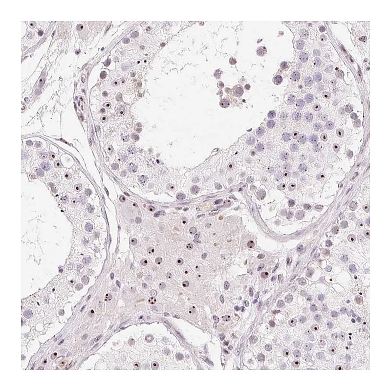 Atlas Antibodies Anti-OBP2A Antibody