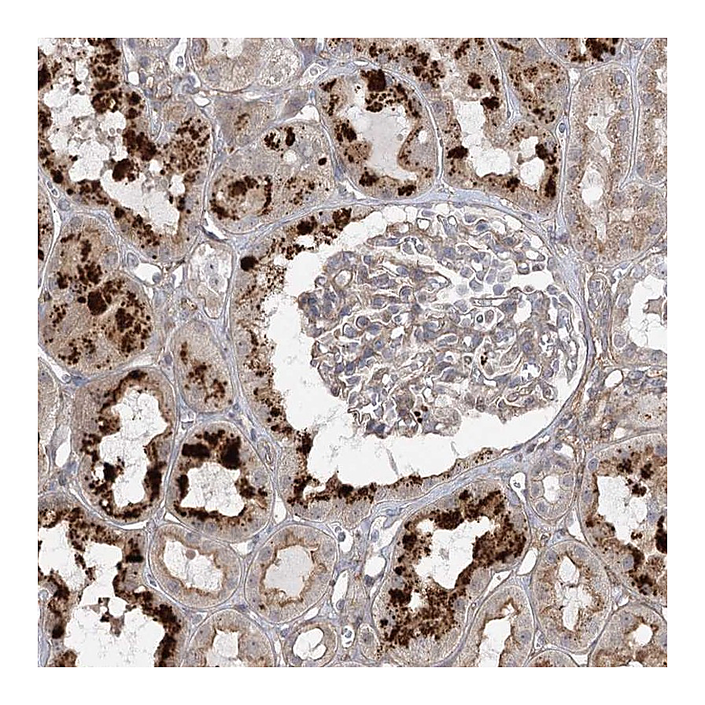 Atlas Antibodies Anti-OBSL1 Antibody