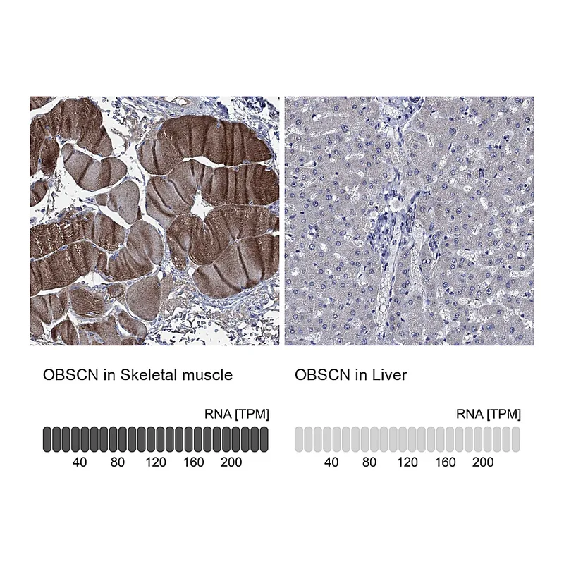 Atlas Antibodies Anti-OBSCN Antibody