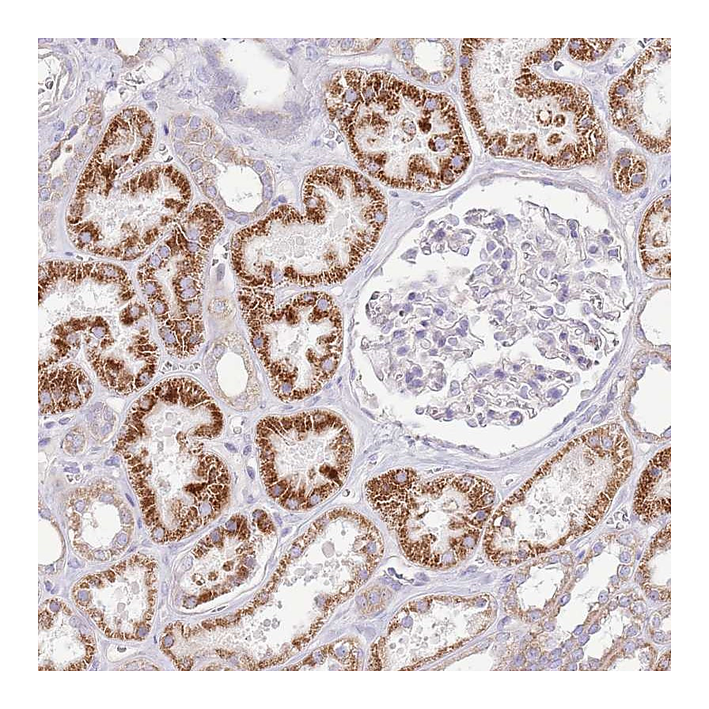 Atlas Antibodies Anti-OAZ2 Antibody