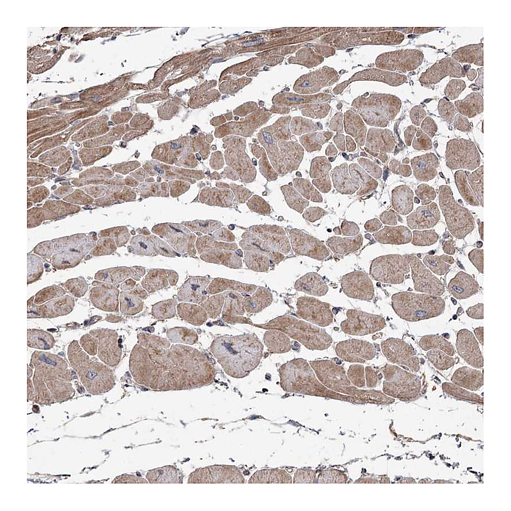 Atlas Antibodies Anti-OBSL1 Antibody