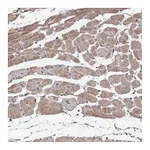 Atlas Antibodies Anti-OBSL1 Antibody