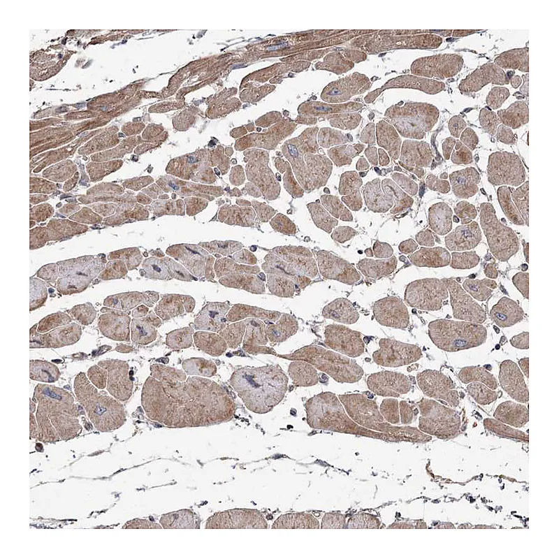 Atlas Antibodies Anti-OBSL1 Antibody