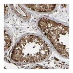 Atlas Antibodies Anti-OCRL Antibody