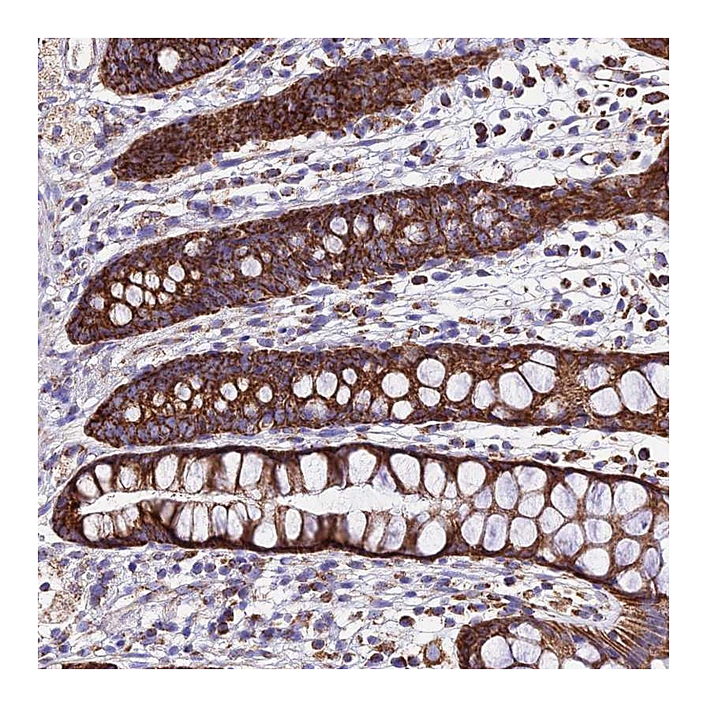 Atlas Antibodies Anti-OCIAD1 Antibody