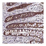 Atlas Antibodies Anti-OCIAD1 Antibody