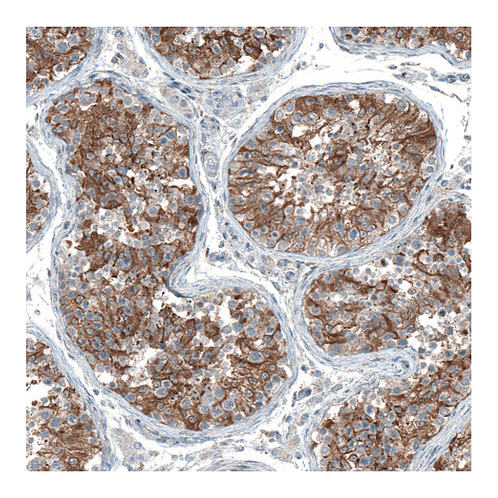 Atlas Antibodies Anti-OCM Antibody