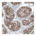 Atlas Antibodies Anti-OCM Antibody