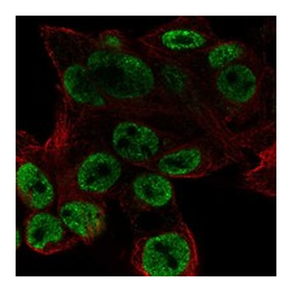 Atlas Antibodies Anti-ODAM Antibody