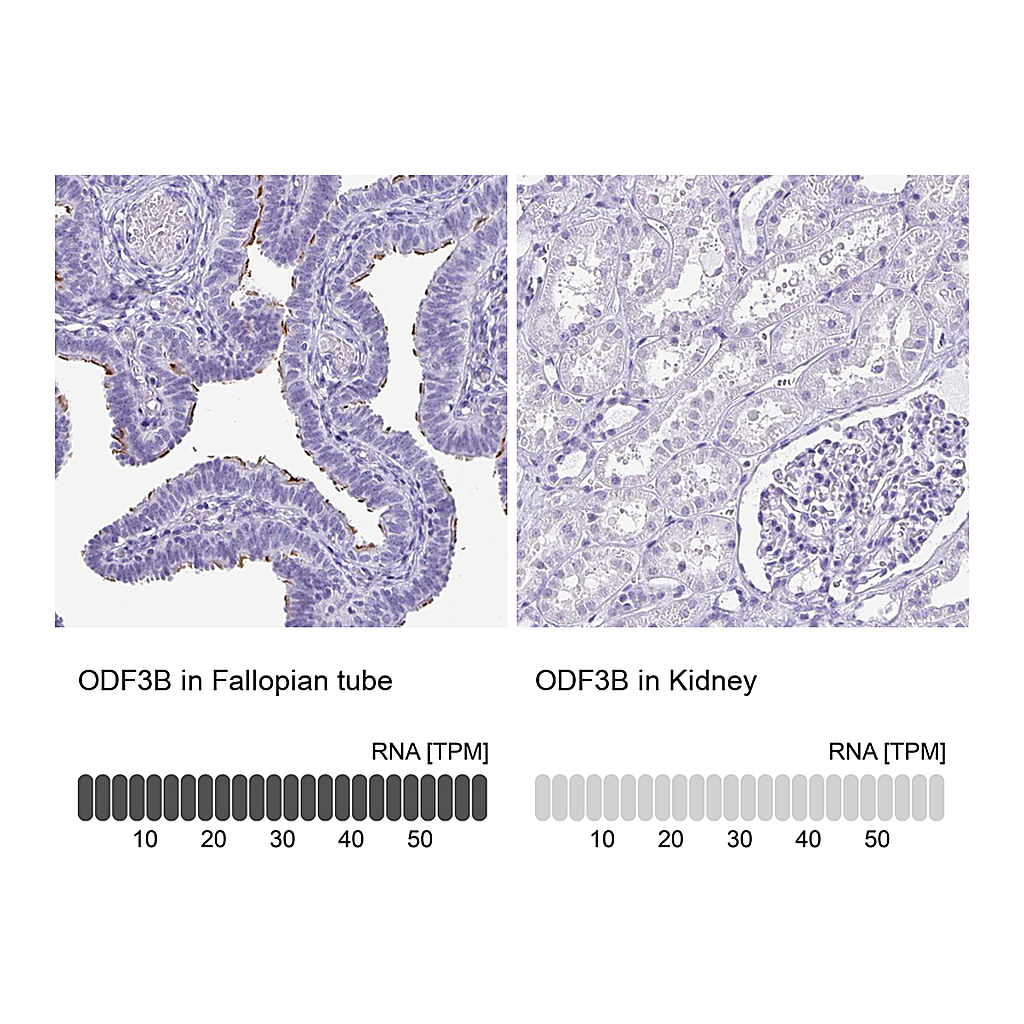 Atlas Antibodies Anti-ODF3B Antibody