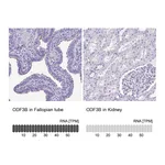 Atlas Antibodies Anti-ODF3B Antibody
