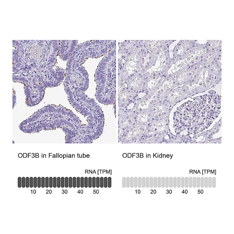 Atlas Antibodies Anti-ODF3B Antibody