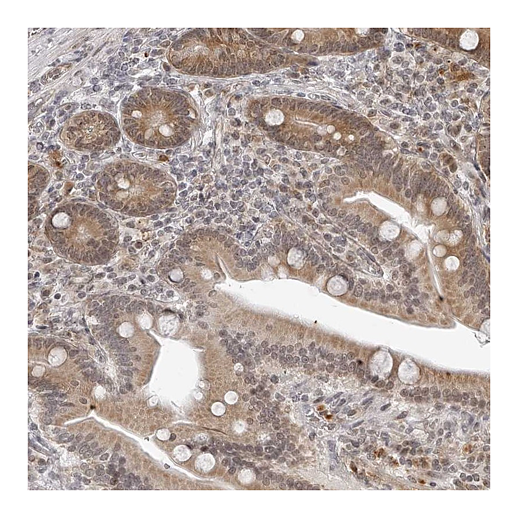 Atlas Antibodies Anti-ODF2L Antibody