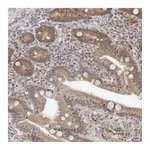 Atlas Antibodies Anti-ODF2L Antibody