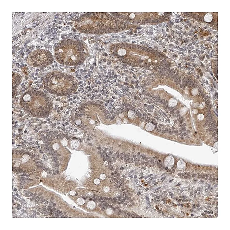 Atlas Antibodies Anti-ODF2L Antibody