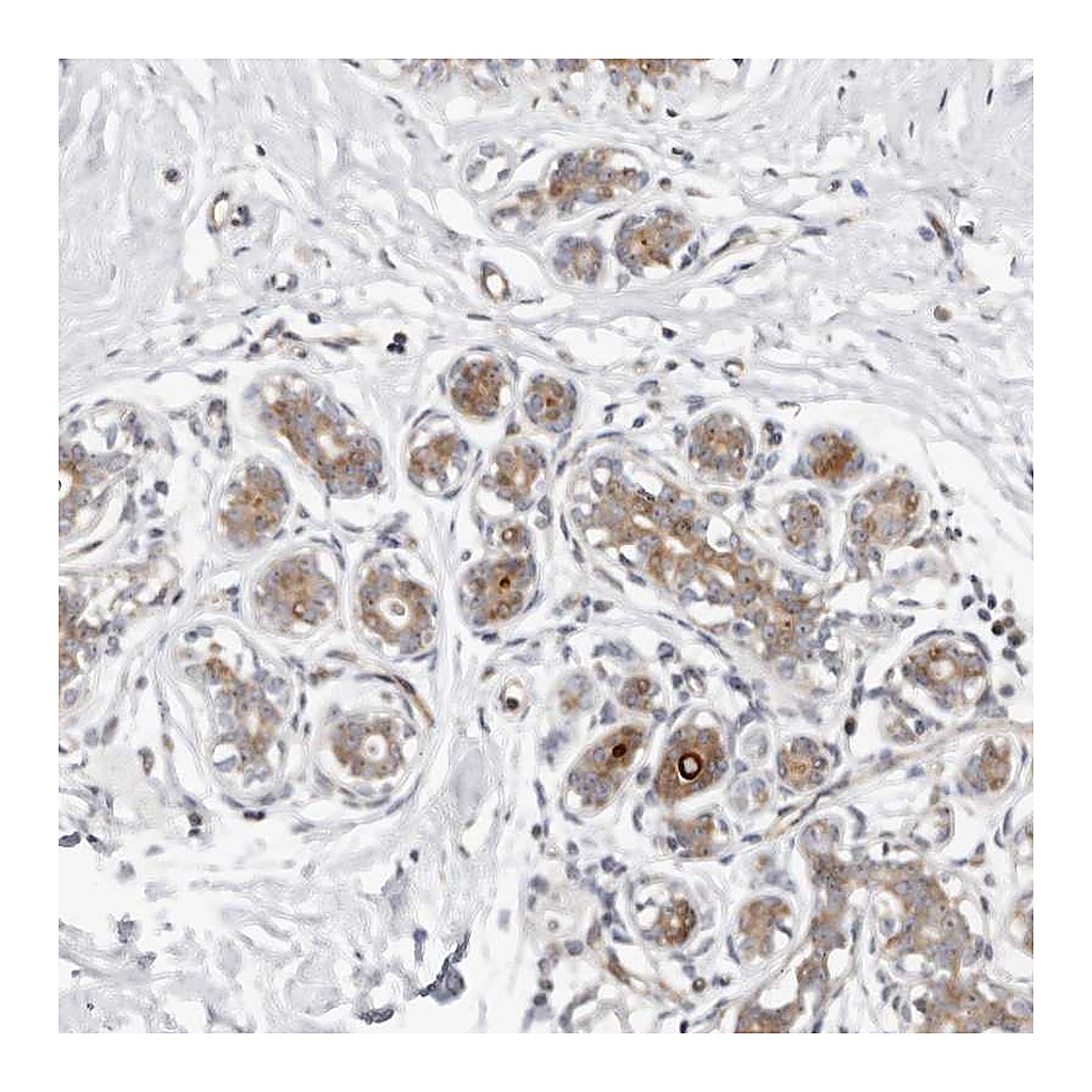 Atlas Antibodies Anti-ODF2L Antibody