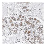Atlas Antibodies Anti-ODF2L Antibody