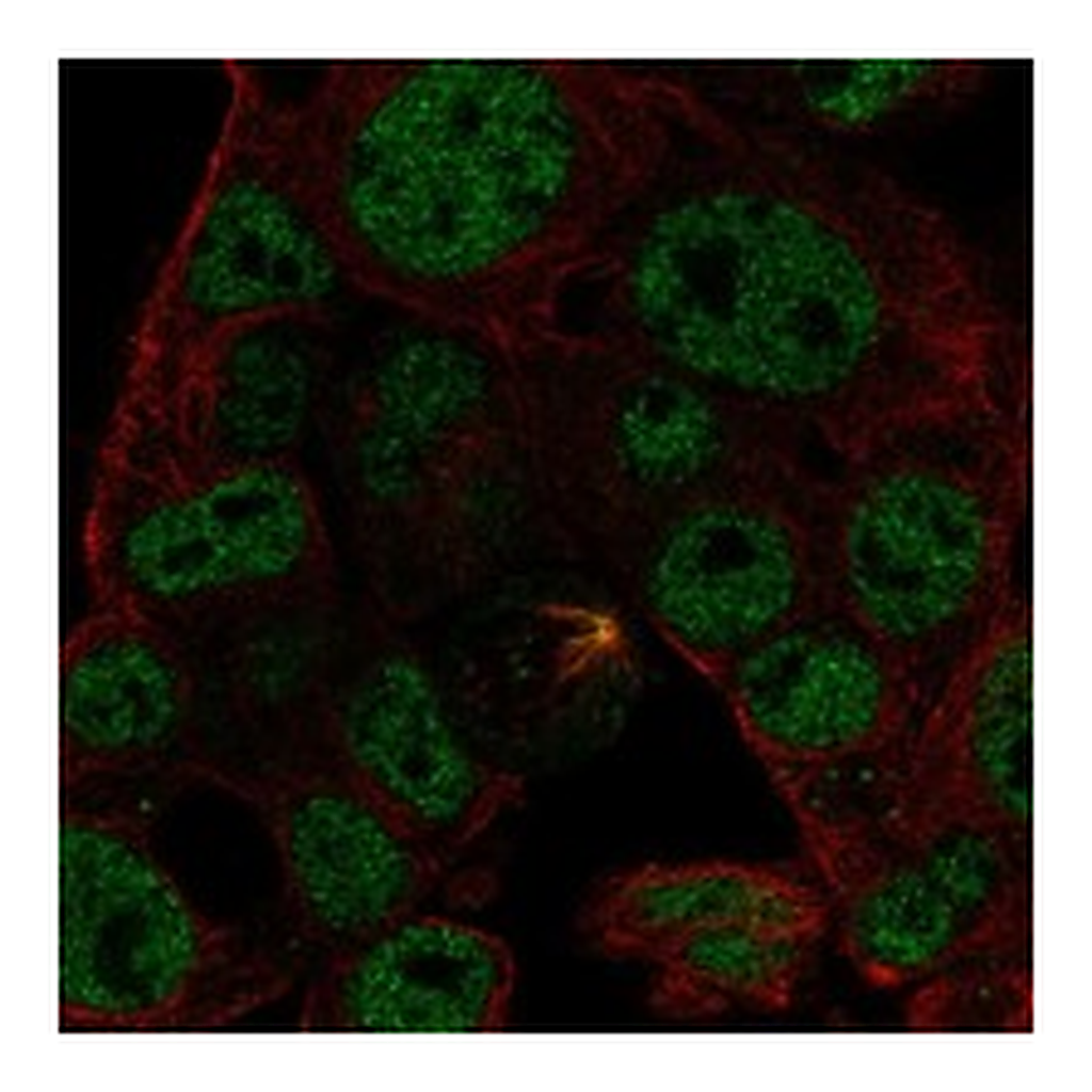 Atlas Antibodies Anti-ODAM Antibody