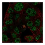 Atlas Antibodies Anti-ODAM Antibody