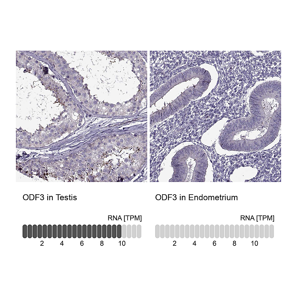 Atlas Antibodies Anti-ODF3 Antibody