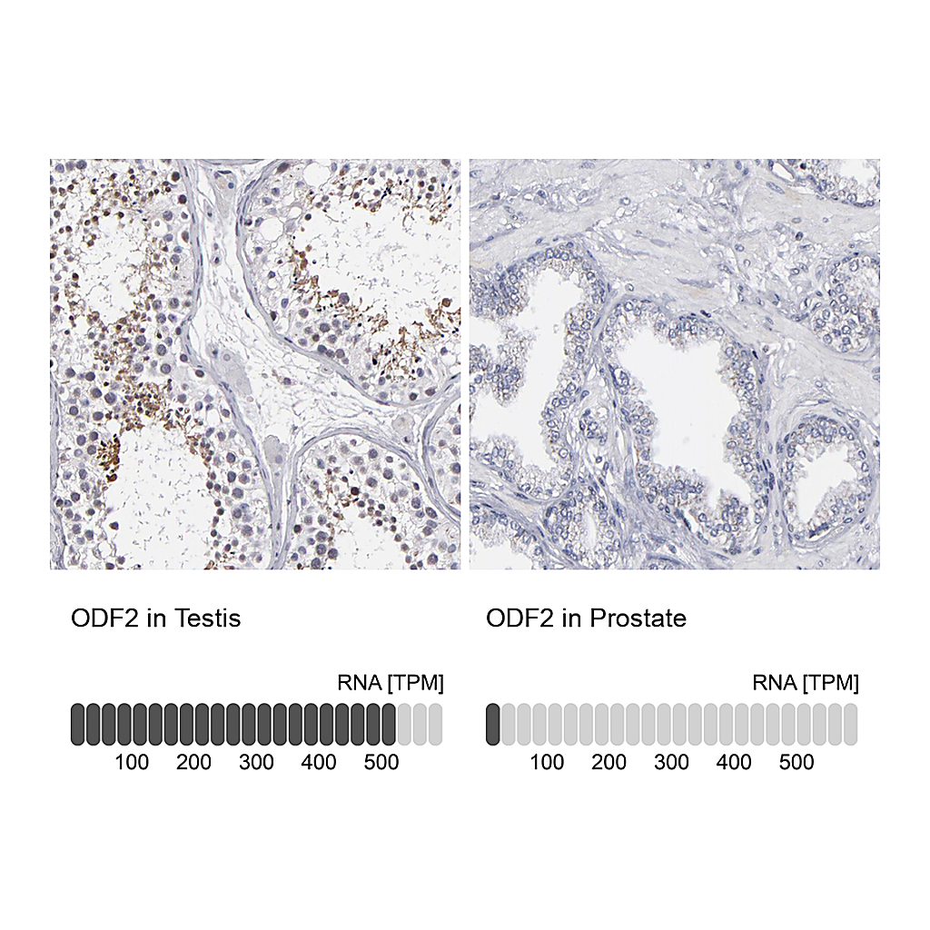 Atlas Antibodies Anti-ODF2 Antibody