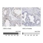 Atlas Antibodies Anti-ODF2 Antibody