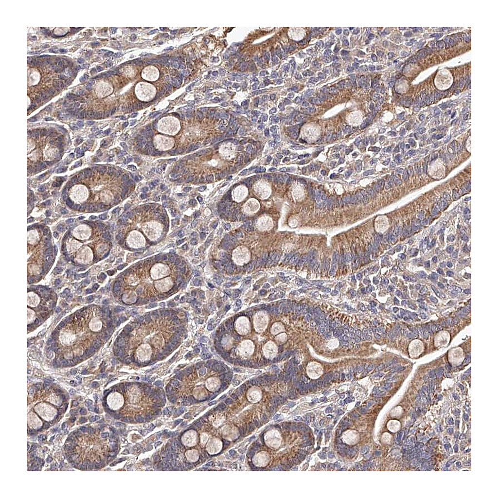 Atlas Antibodies Anti-ODF2L Antibody
