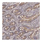 Atlas Antibodies Anti-ODF2L Antibody