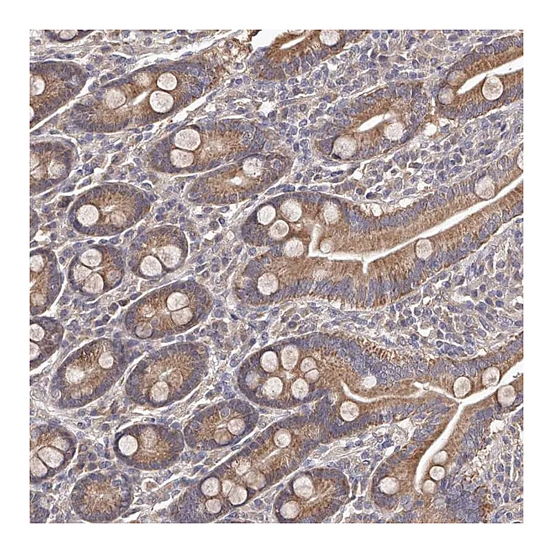 Atlas Antibodies Anti-ODF2L Antibody