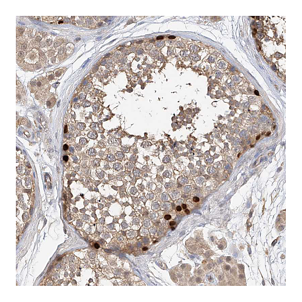 Atlas Antibodies Anti-OFD1 Antibody