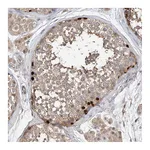 Atlas Antibodies Anti-OFD1 Antibody