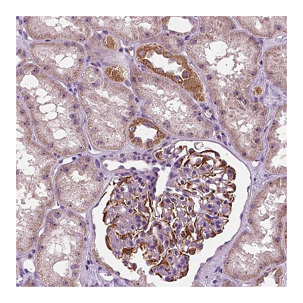 Atlas Antibodies Anti-ODF3L2 Antibody