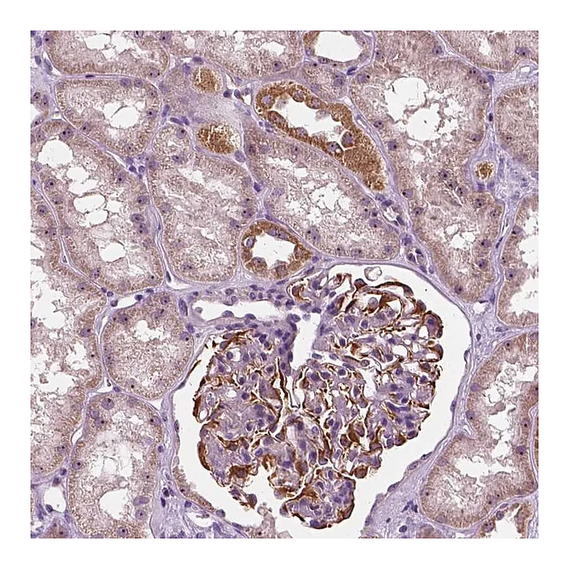 Atlas Antibodies Anti-ODF3L2 Antibody