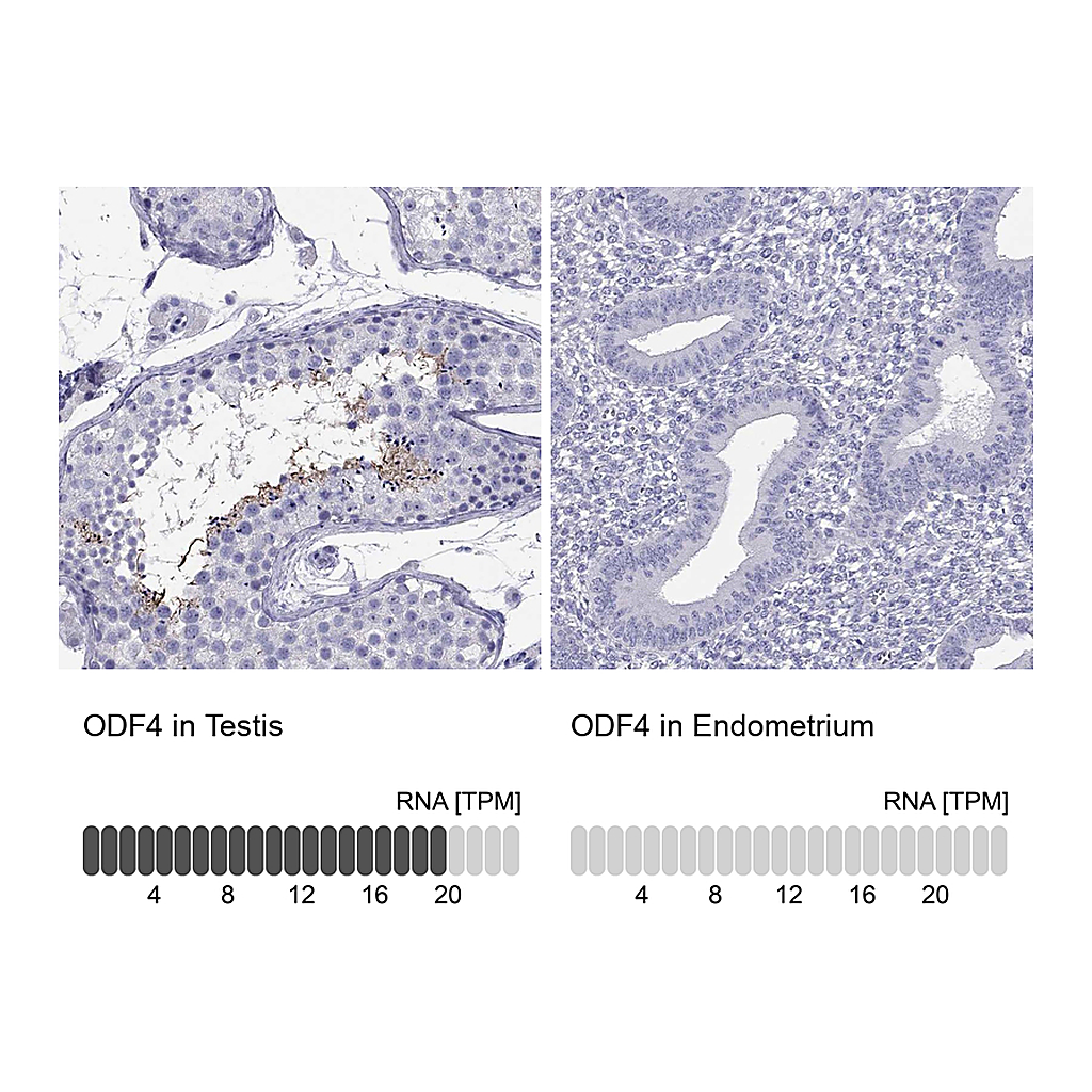 Atlas Antibodies Anti-ODF4 Antibody