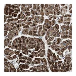 Atlas Antibodies Anti-OGDH Antibody