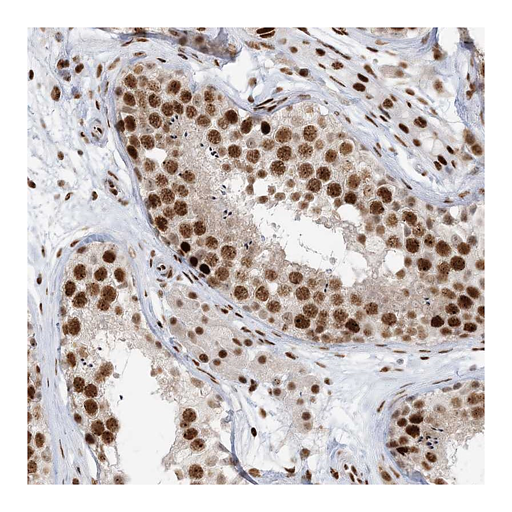 Atlas Antibodies Anti-OFCC1 Antibody