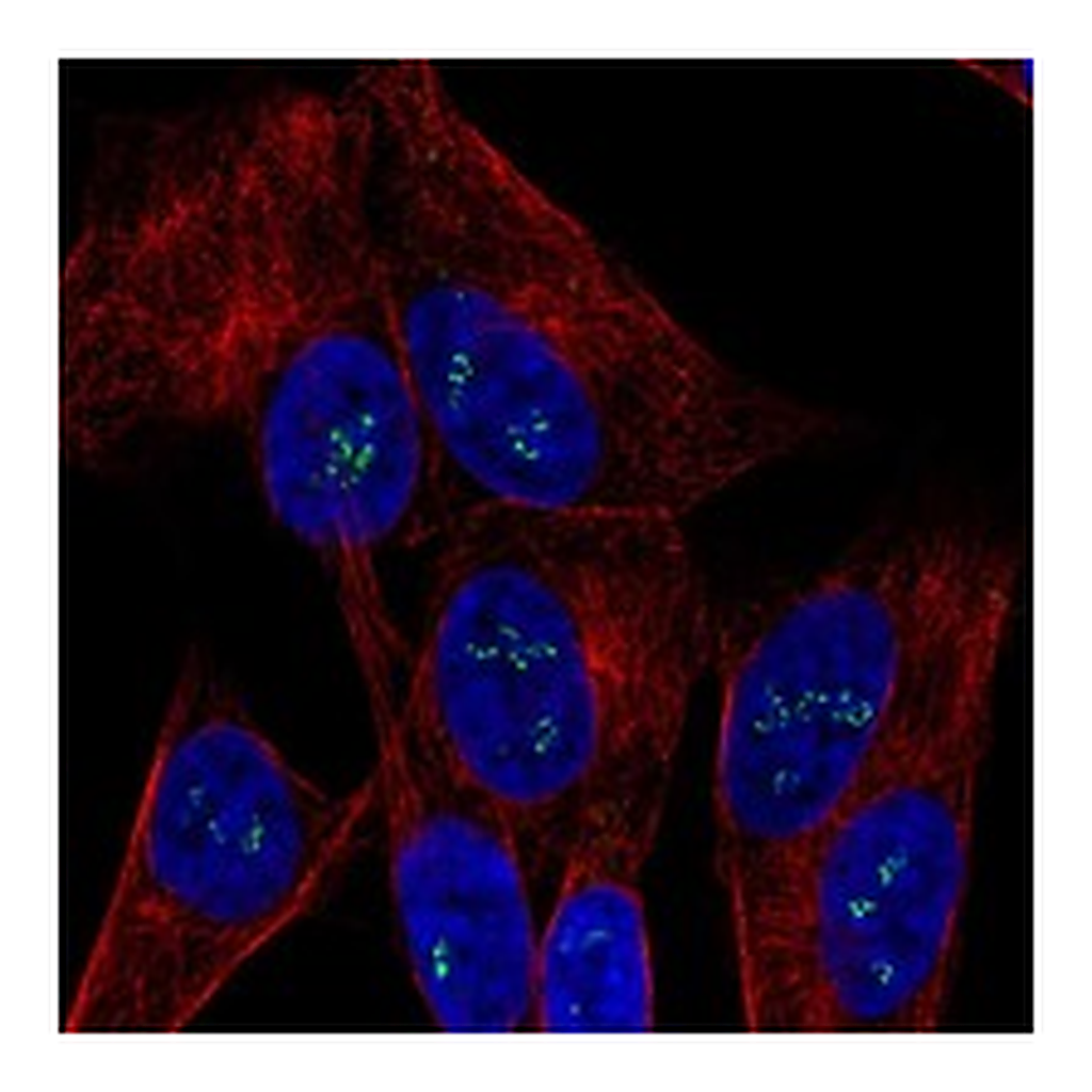 Atlas Antibodies Anti-OGDHL Antibody