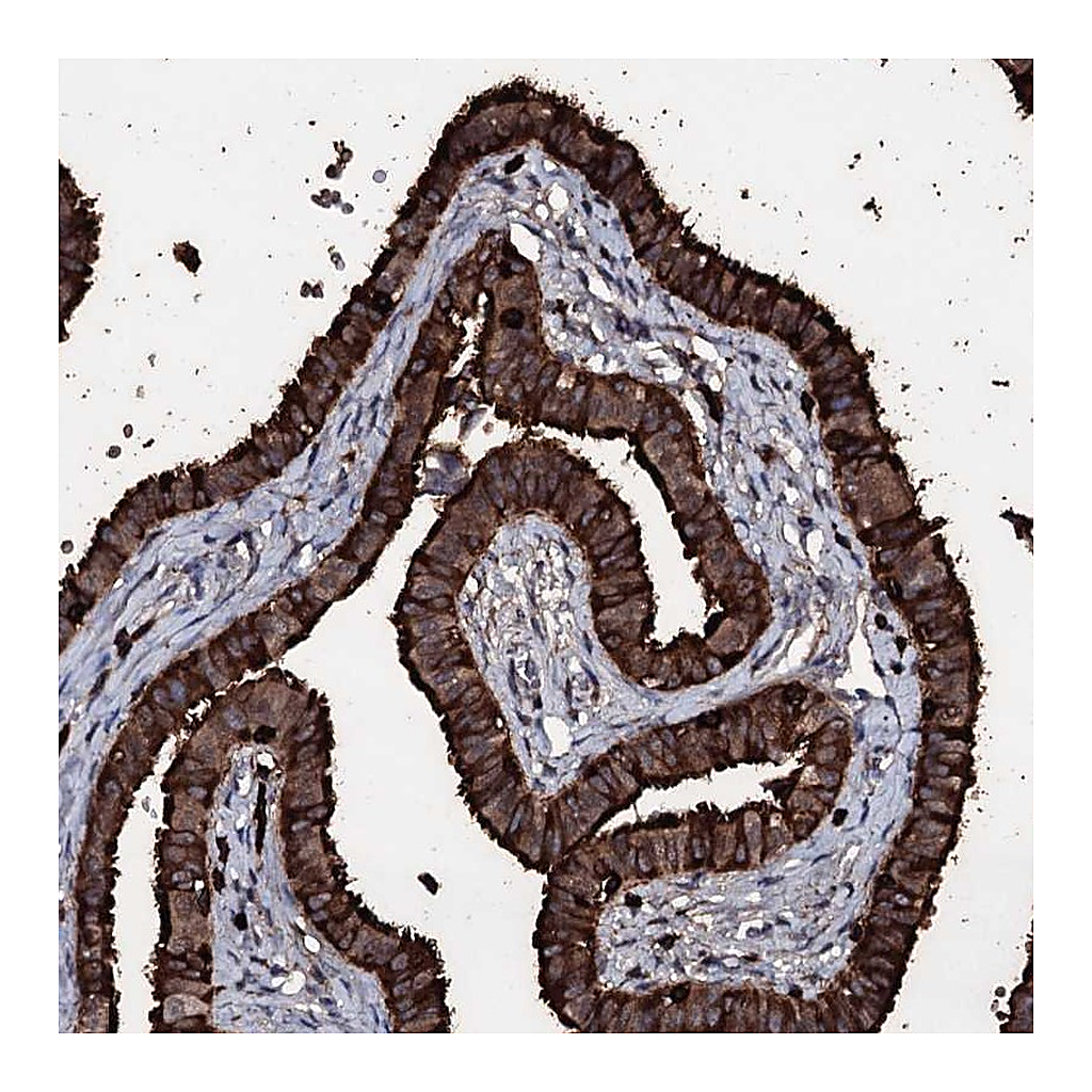 Atlas Antibodies Anti-OGFOD2 Antibody