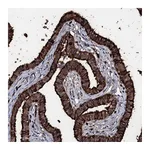 Atlas Antibodies Anti-OGFOD2 Antibody