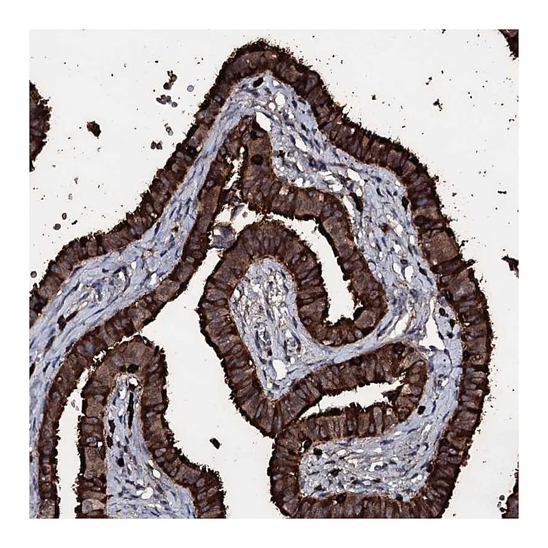 Atlas Antibodies Anti-OGFOD2 Antibody