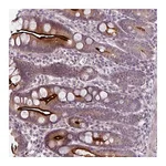 Atlas Antibodies Anti-OGFOD3 Antibody