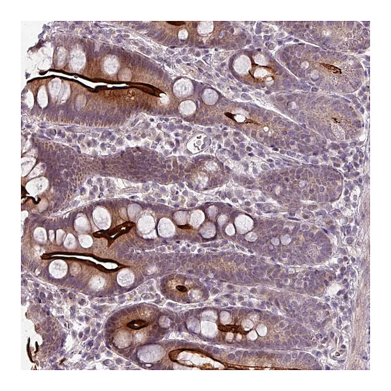 Atlas Antibodies Anti-OGFOD3 Antibody
